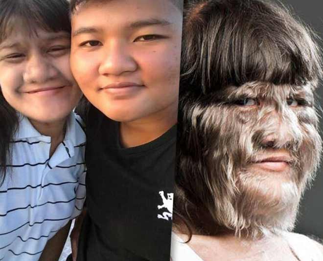 woman with rare diesease