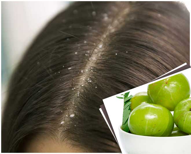 Amla benefits inside