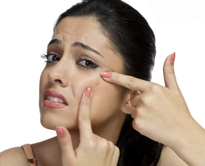 Follow these tips for monsoon skin and hair problems  