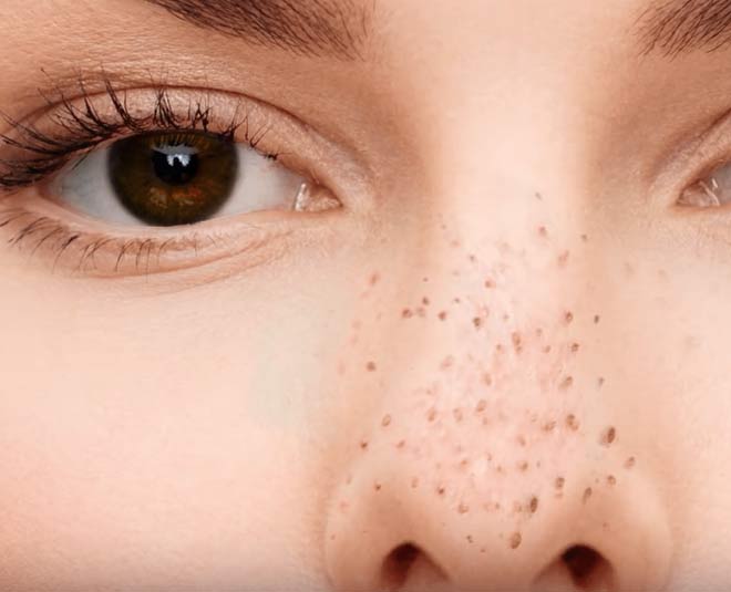 Follow these tips for monsoon skin and hair problems  