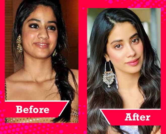 Bollywood Actress Successful Cosmetic Surgery in hindi -जाह्नवी कपूर की