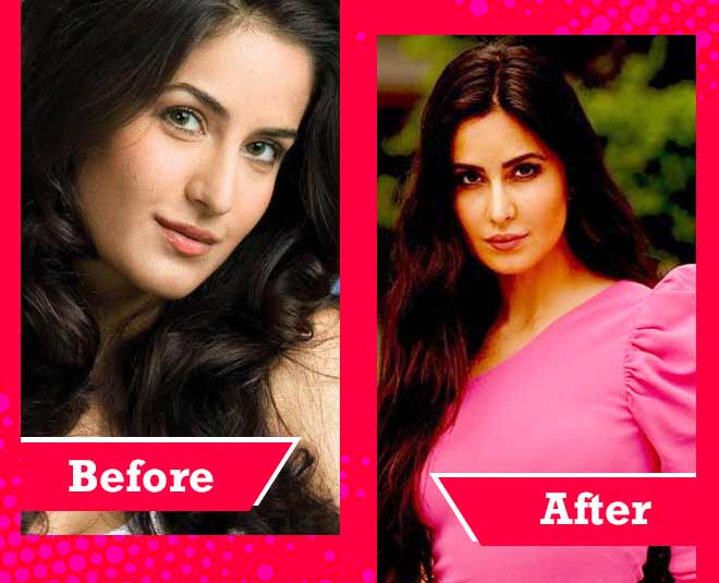 Bollywood Actress Successful Cosmetic Surgery in hindi