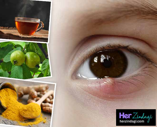आंख की फुंसी गुहेरी को 2 दिन में खत्म करते है ये आसान घरेलू नुस्खें