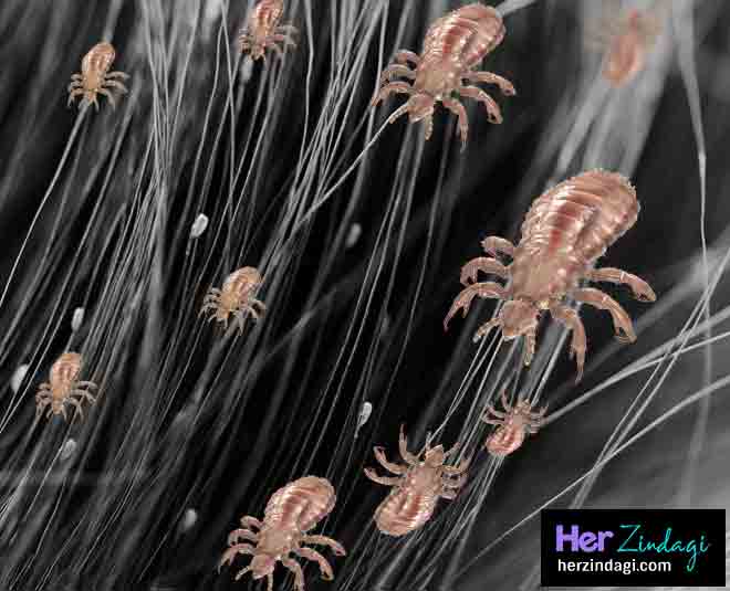 By mayonnaise get rid of lice in one day by mayonnaise get rid of