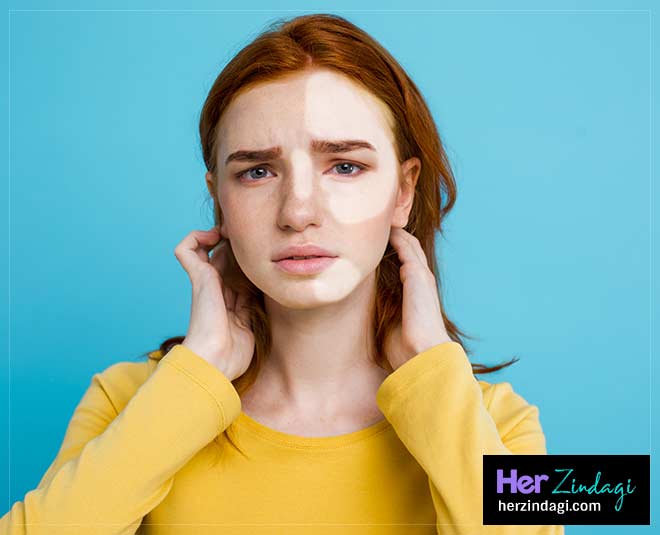 white spots health ()