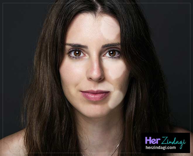 white spots health ()