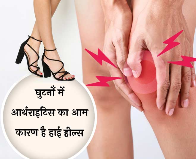 Osteoarthritis health in women '