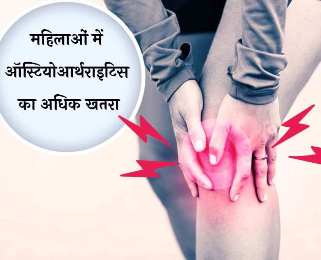 Osteoarthritis health in