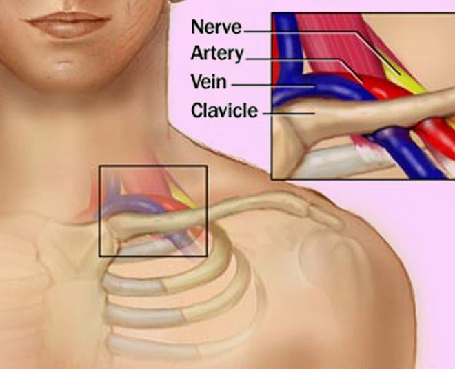 collorbone pain in