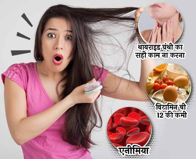 These diseases are causes of dandruff and avoid these products | these  diseases are causes of dandruff and avoid these products | HerZindagi
