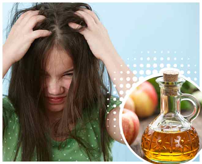 जुओं से मिलता है छुटकारा Benefits Of Apple Cider Vinegar For Skin Hair And Health in