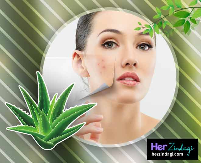 पिगमेंटेशन हटाए एलोवेरा aloevera can cure skin problems in summer inside