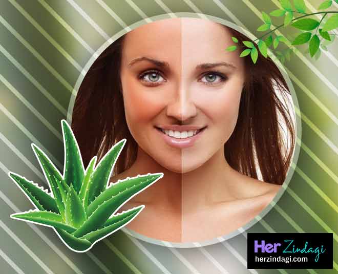 सनटैन दूर करे aloevera can cure skin problems in summer inside