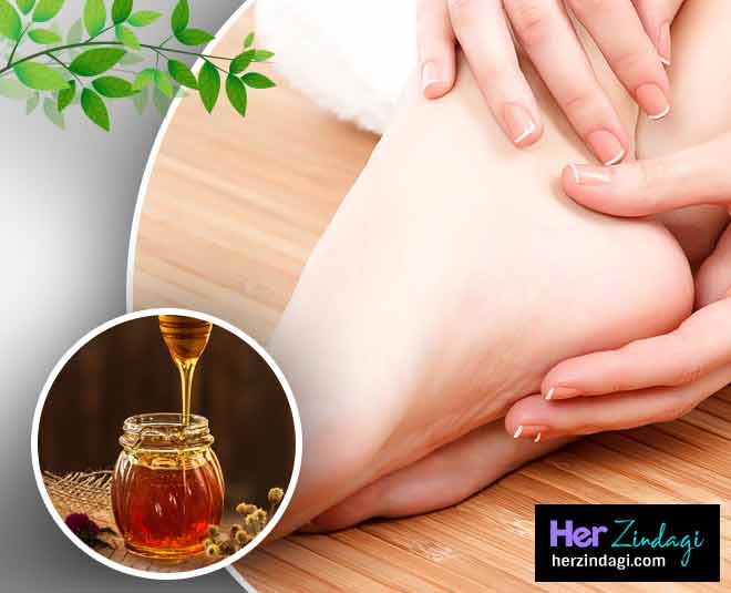 शहद beautifull feet remedies in summer INSIDE