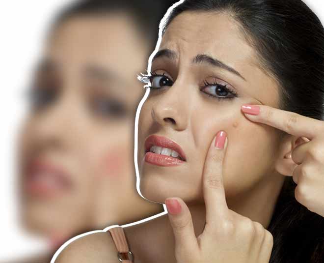 beauty benefits of sprouts inisde