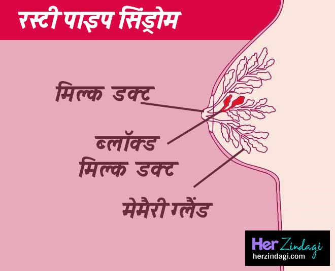 blood coming with breast milk during breastfeeding inside 