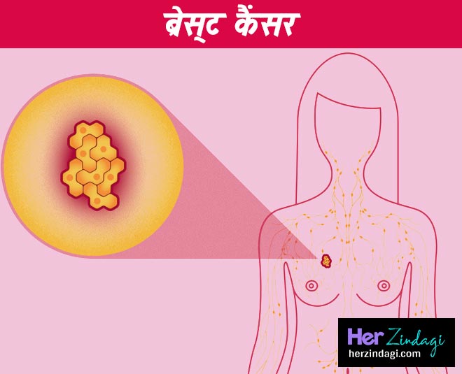 blood coming with breast milk during breastfeeding inside 