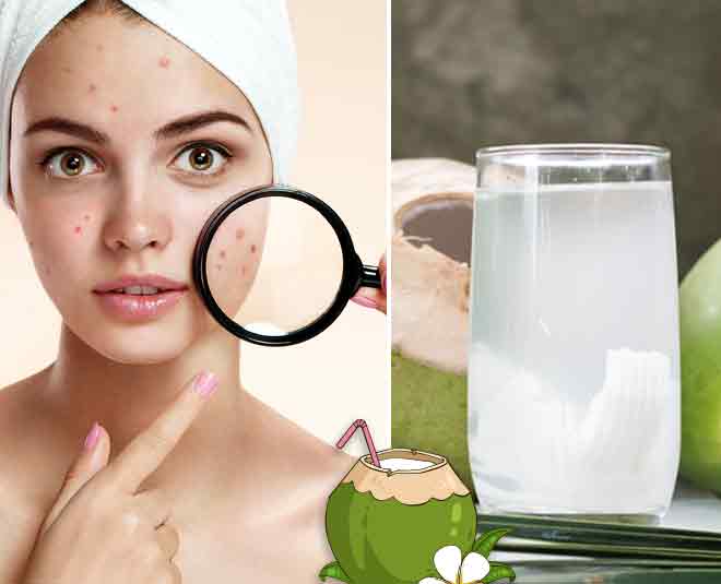 Skin And Hair Care Coconut Water Beauty Benefits Home Remedies In