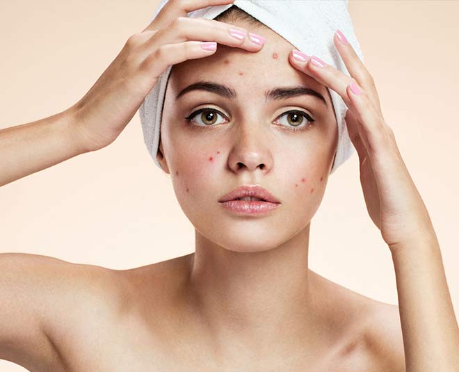 हो सकते हैं पिंपल्स in these ways your phone is messing with your skin inside