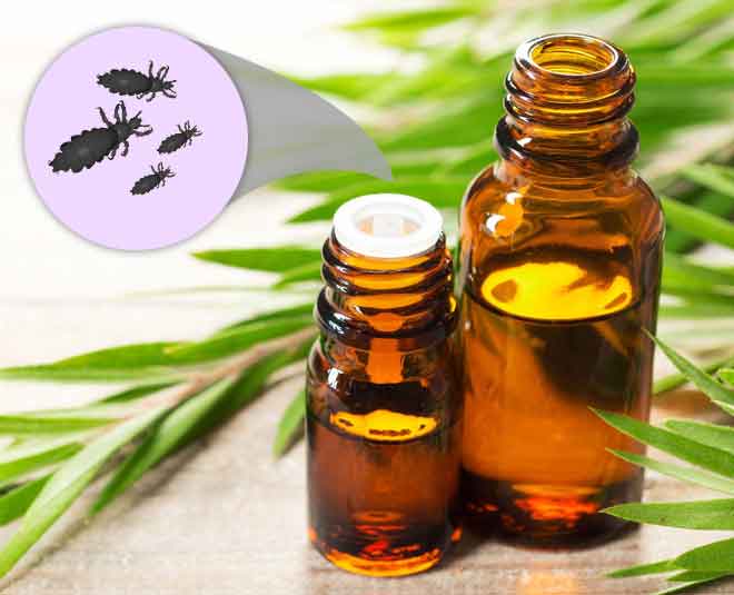 lice problem in summer cinsideard