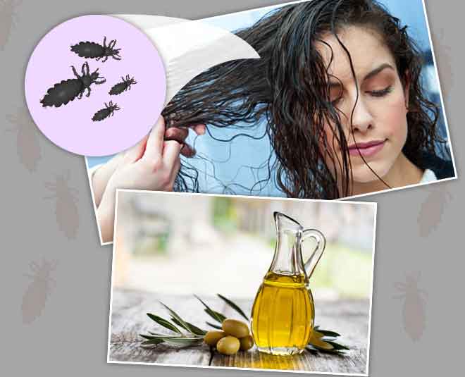 lice problem in summer cinsideard