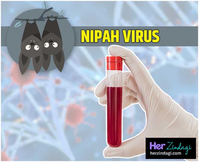 nipah virus MAIN