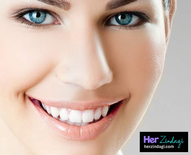 pros cons teeth whitening or bleaching inside 