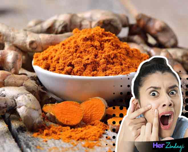 Do Spices Cause Pimples