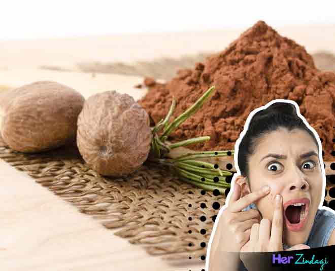 जायफल spices to cure pimples in
