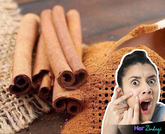दालचीनी spices to cure pimples in