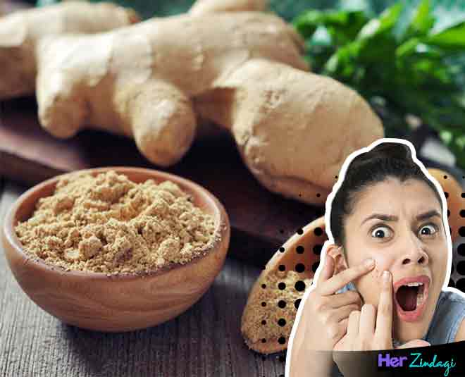 spices-will-help-you-get-rid-of-our-pimples