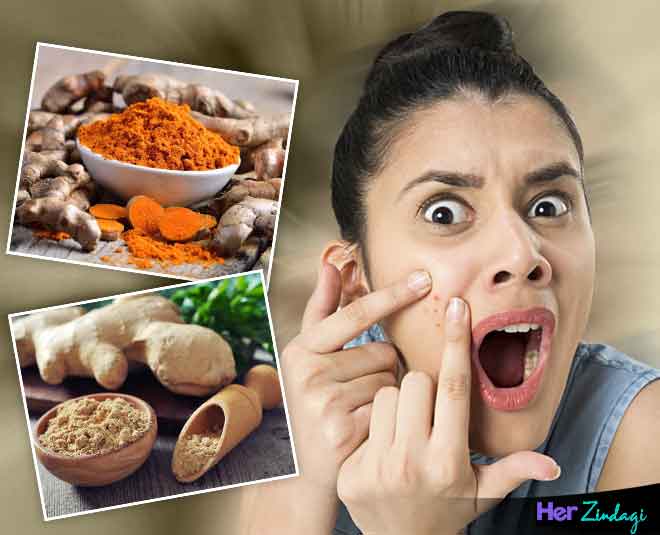 spices to cure pimples main