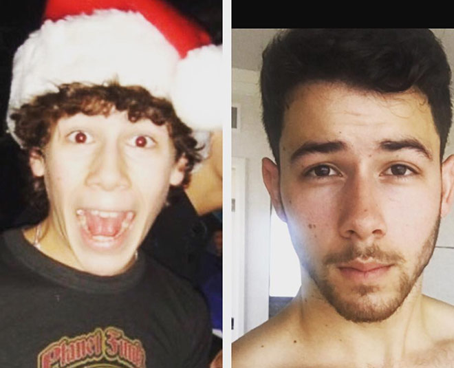 Priyanka Chopra would be husband Nick Jonas had diabetes he tells his treatment story 