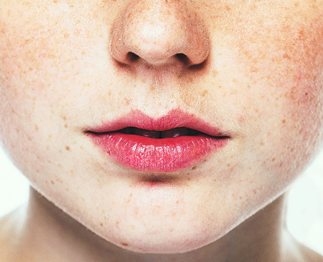 pigmentaiton skin inside