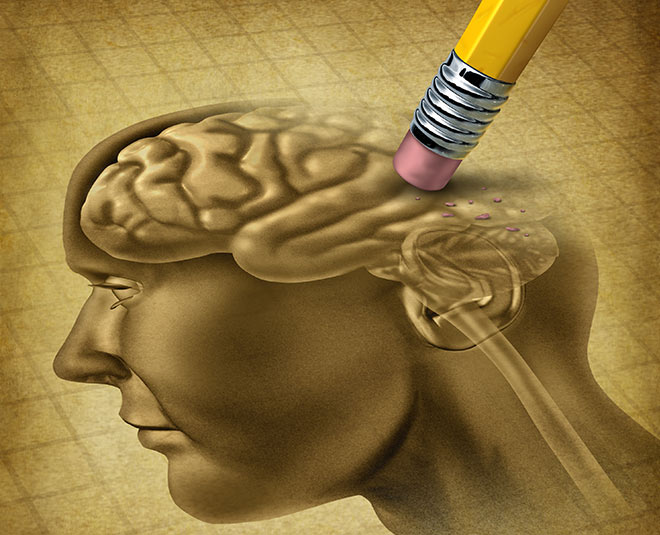 alzheimers disease health inside