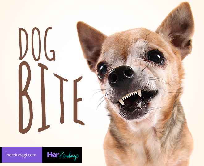 World Rabies Day: कुत्ते के काटने पर तुरंत ये उपचार करने से नहीं फैलता है जहर