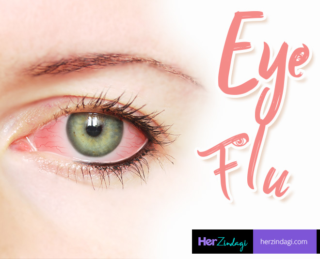 expert-easy-home-remedies-for-eye-flu-conjunctivitis-expert-easy-home