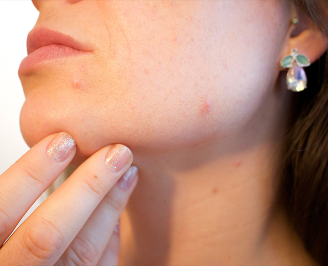 glycerin benefit on your skin pimple