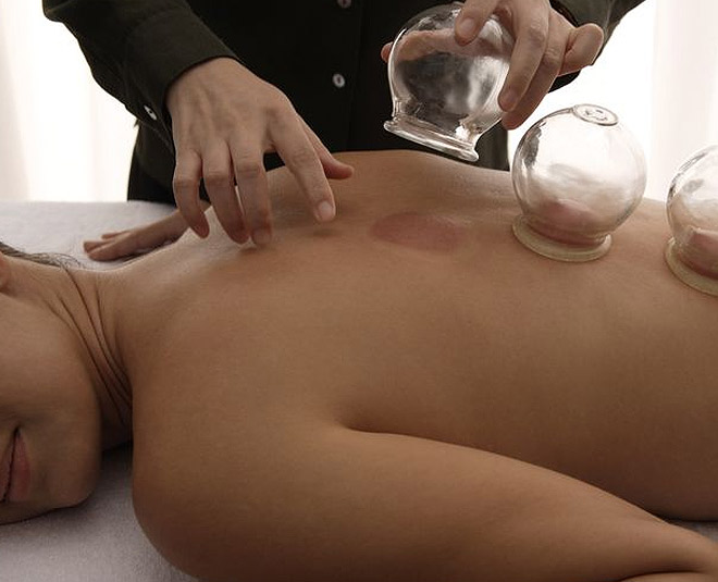 cupping spa massage