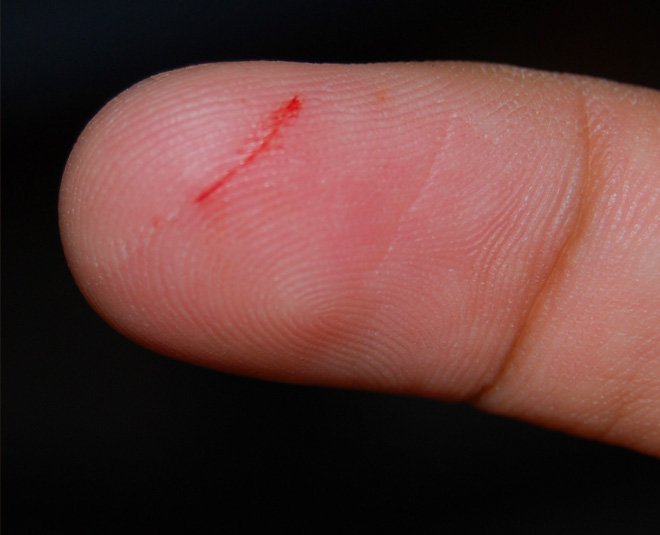 benefits of alum or fitkari inside 