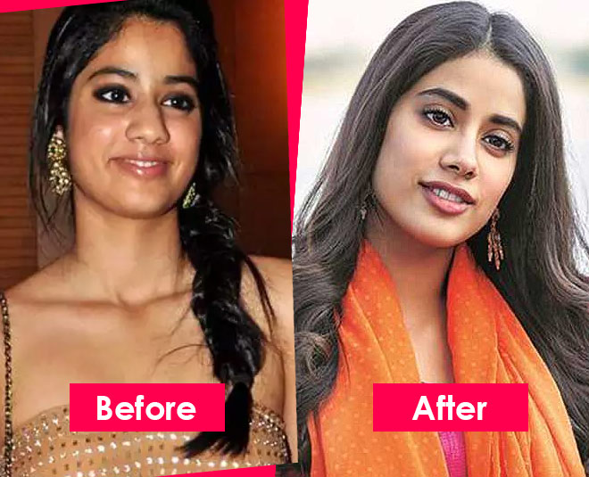 Check Out How Bollywood And TV Actresses Change Post Plastic Surgery ...