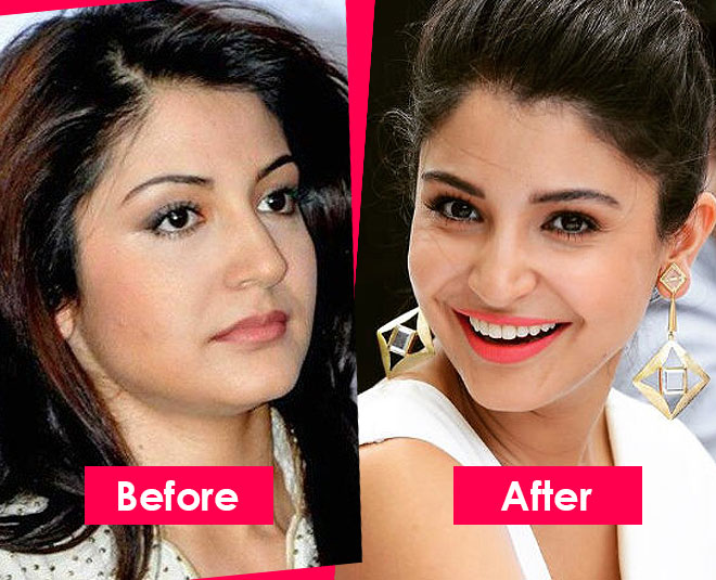 bollywood actress before after inside 