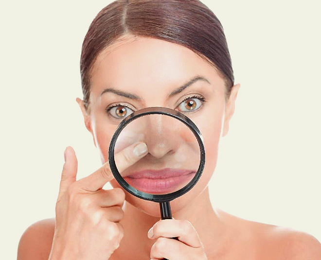 get rid of  blackheads by using egg white recipe