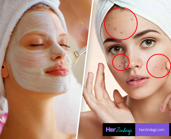 Bleaching Cause Itching Then Try These Home Remedies