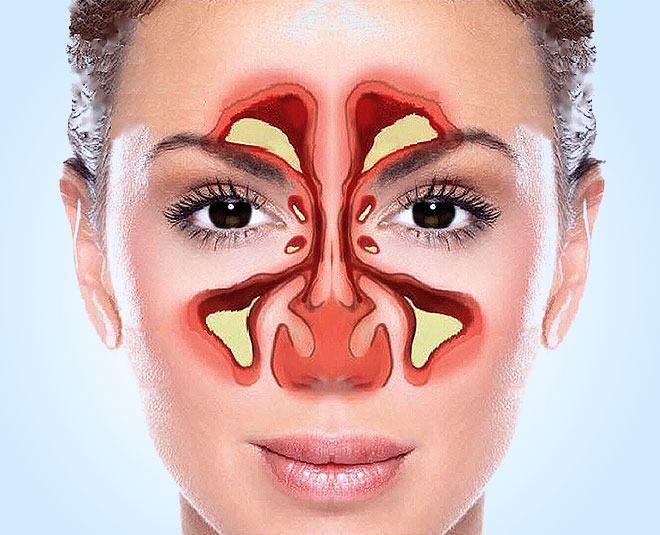 sinus problem health main