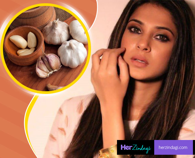 Use Garlic At Home To Prevent Hair Loss & Dandruff | HerZindagi