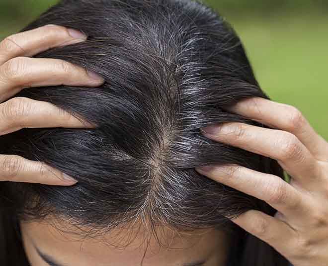 kills dandruff oil massage