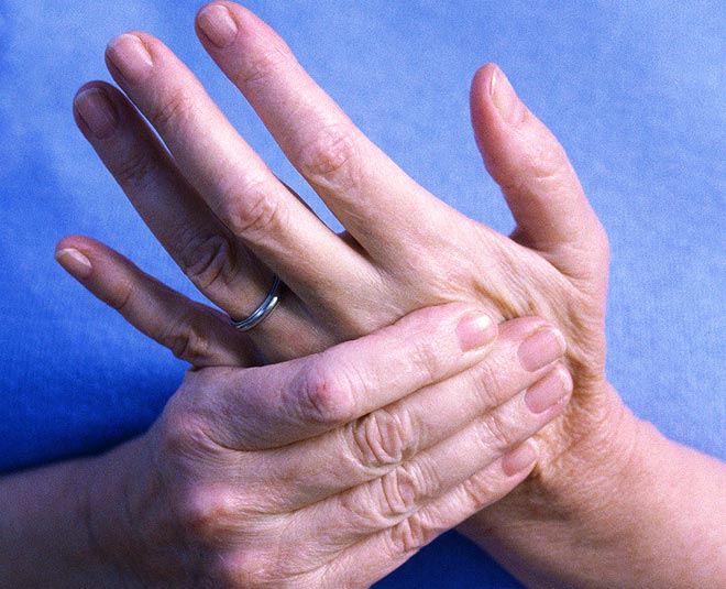 arthritis mango side effects