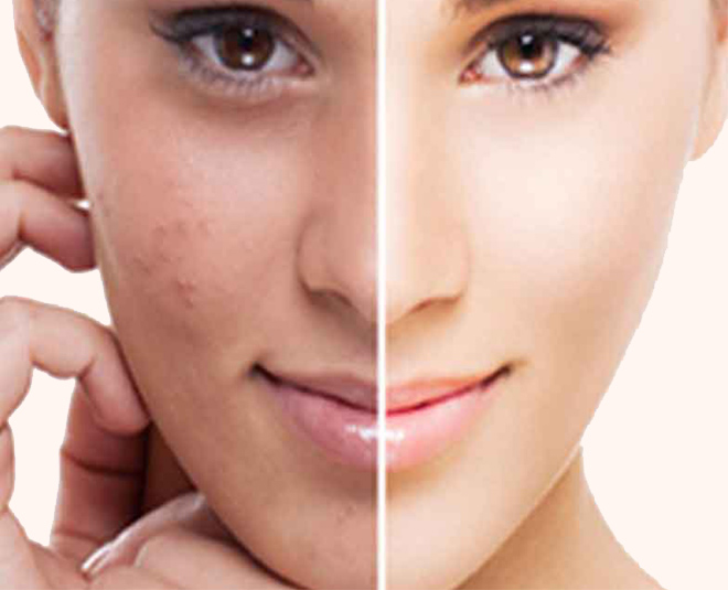 Gharelu Nuskhe 5 Atta Face Packs For Clear and Glowing Skin 5 atta