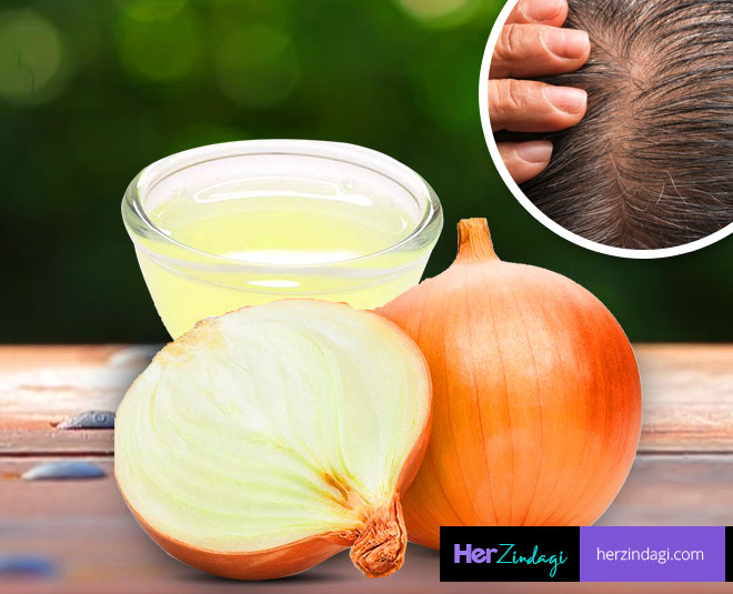 onion juice hair growth ()